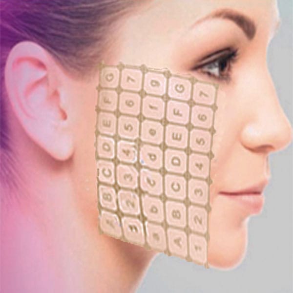 Morfolifting - RF fractionné. Réf. : 1389