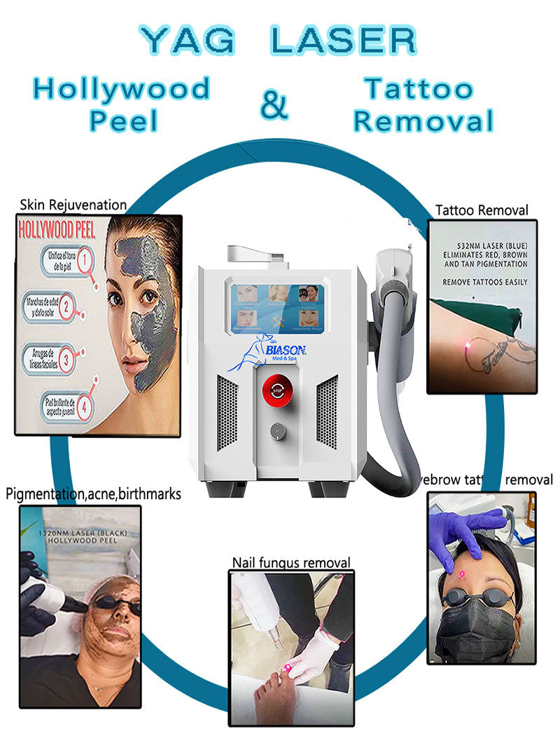 Yag Laser Tattoo Removal- Ref.1197