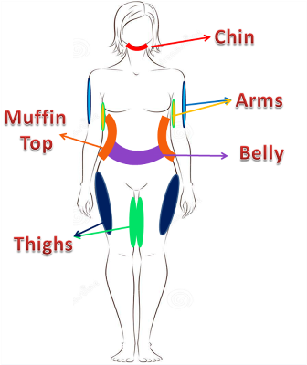 Lipo Laser perfection -Ref. 1449