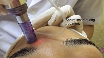 Inject Micro pen - Ref.1616